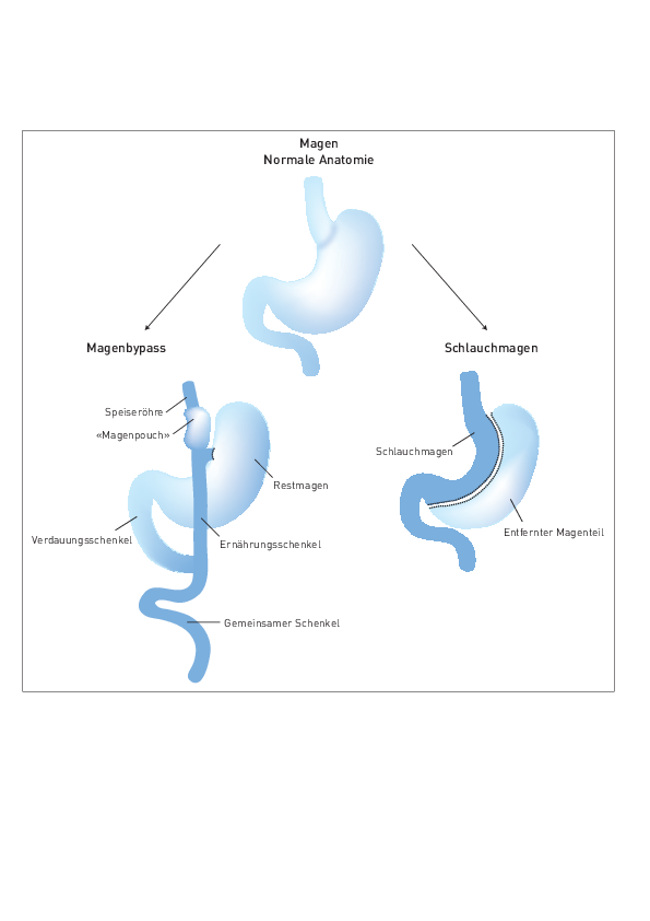 Schema_Bariatrie_2018